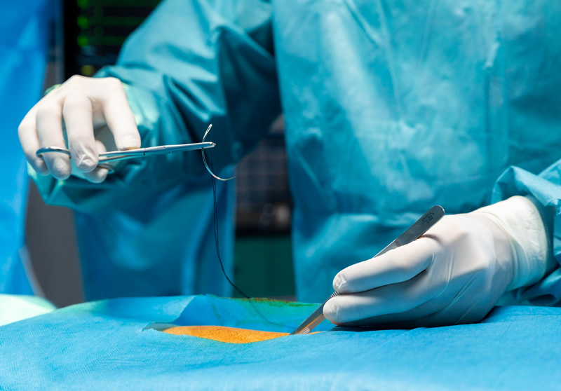 Evde Dikiş Alma Atma